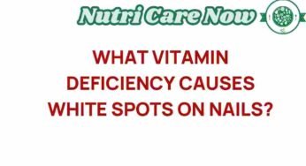 Unveiling the Mystery: What Vitamin Deficiency Causes White Spots on Nails?